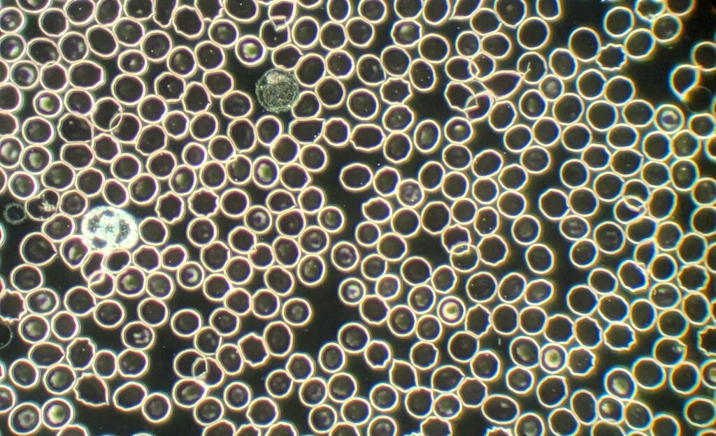 Live Blood Analysis Picture