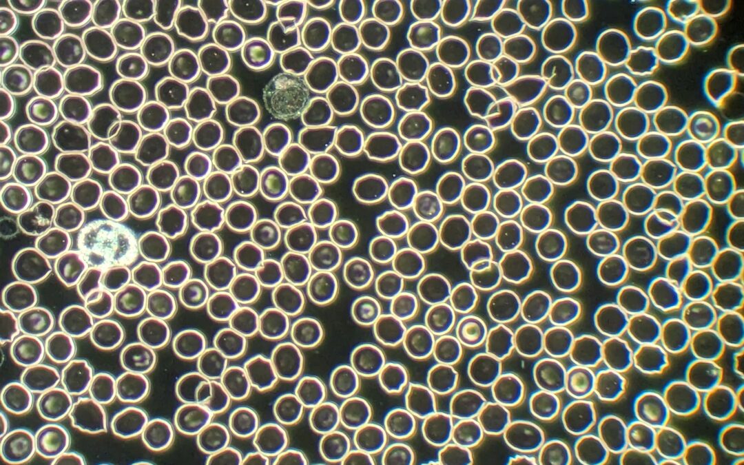 Live Blood Analysis Picture