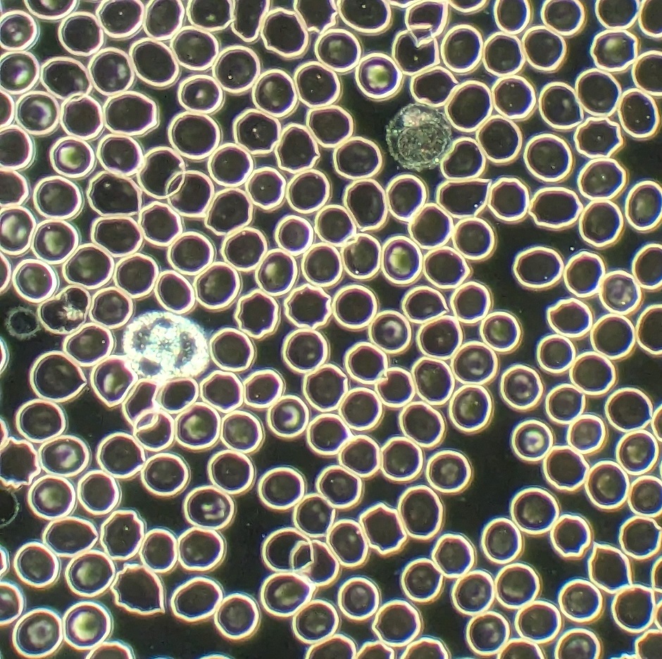 Live Blood Analysis Picture