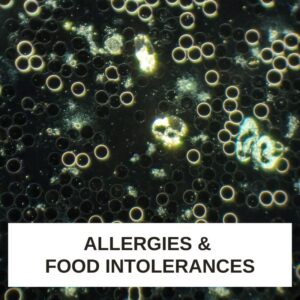 Allergies and Food Intolerances LBA