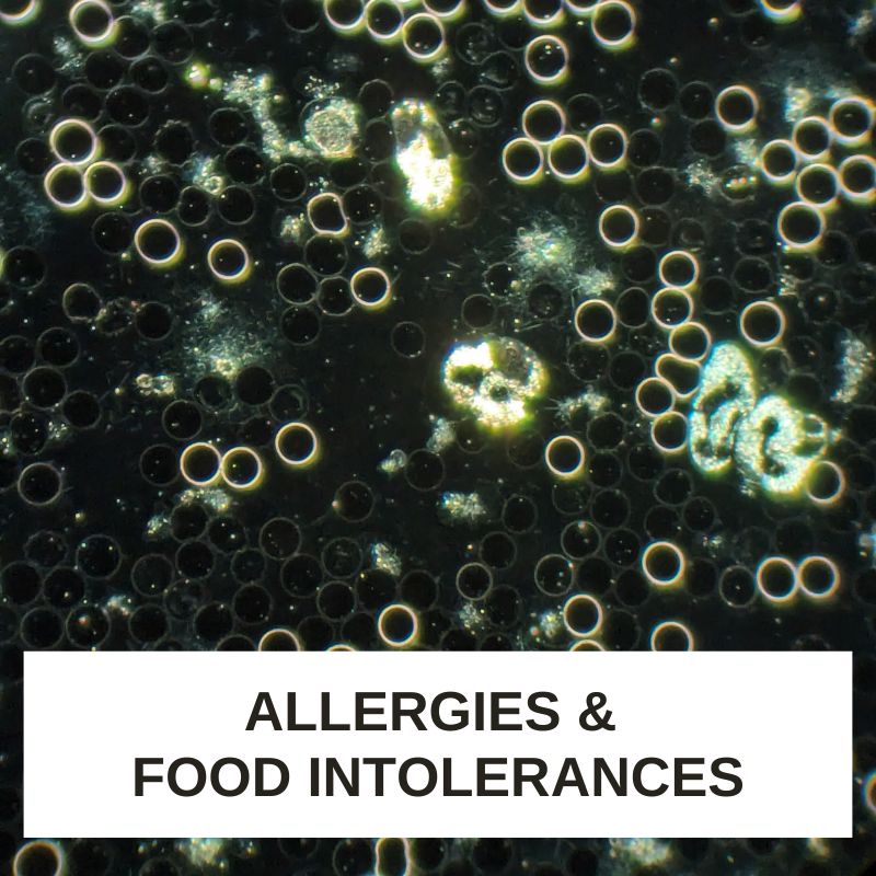 Allergies and Food Intolerances LBA