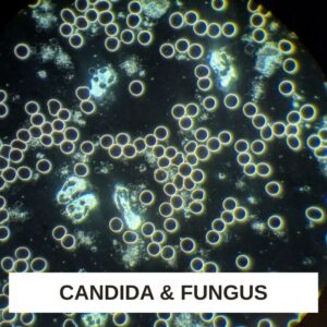 Candida and Fungus LBA