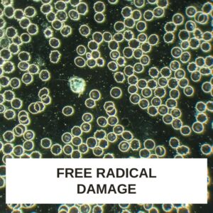 Free Radical Damage LBA