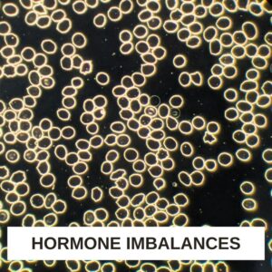 Hormone Imbalances LBA