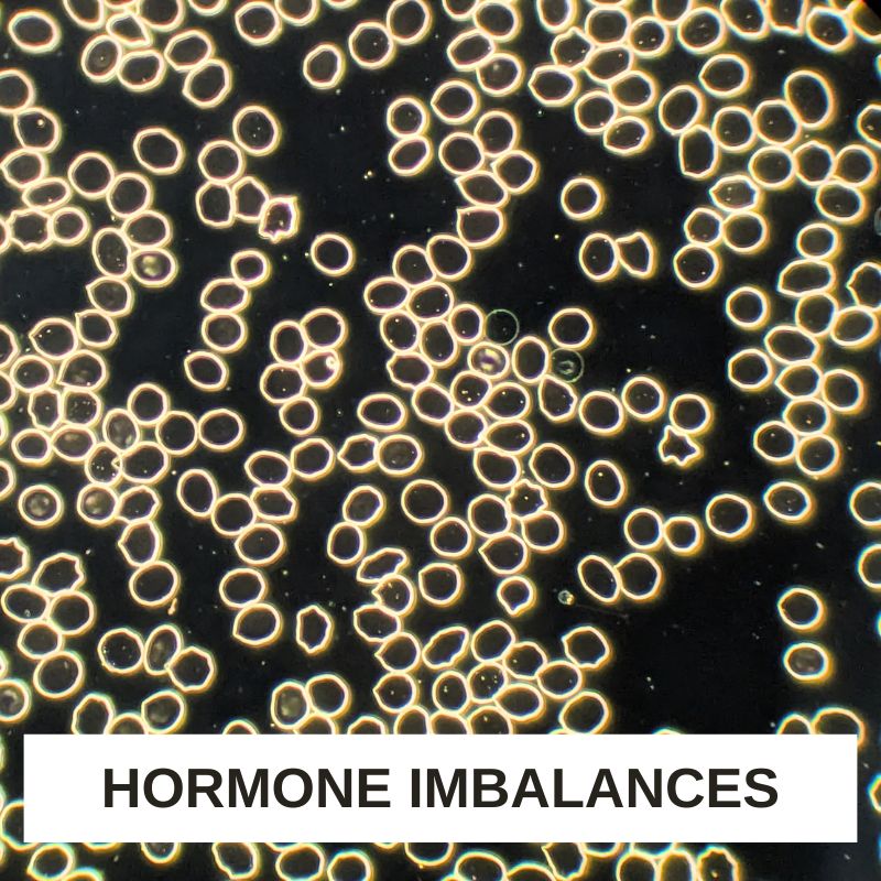 Hormone Imbalances LBA