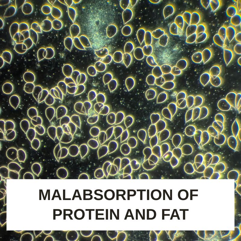 Malabsorption of Protein and Fat LBA