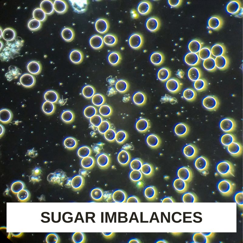 Sugar Imbalances LBA